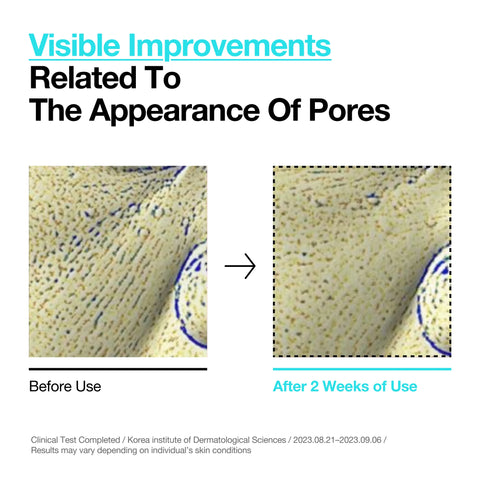 Even tone & Pore Refining Duo