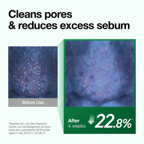 Heartleaf Pore Control Cleansing Oil